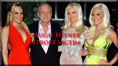 Hugh Hefner stroke victim